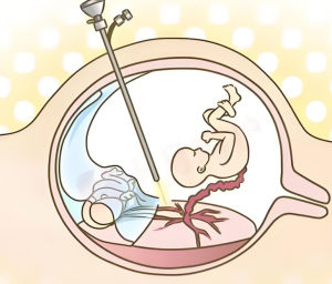 Read more about the article 多久打掉的孩子叫嬰靈 ？墮胎後特別倒黴可能是嬰靈作祟